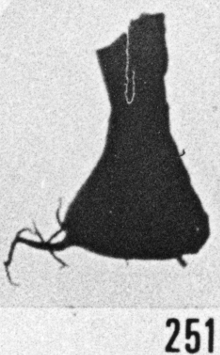 Fig. 251 - Ancyrochitina ancyrea (Eisenack). -185,00 m. b 346.