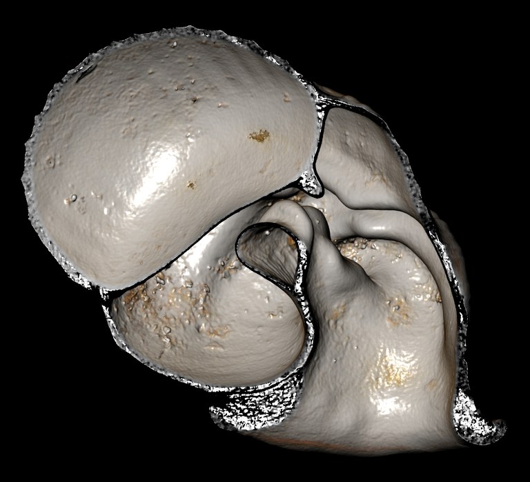 BE-RBINS-INV-MT-2878-Ennea-chaperi-pt-frontal-internal-BIG.jpg