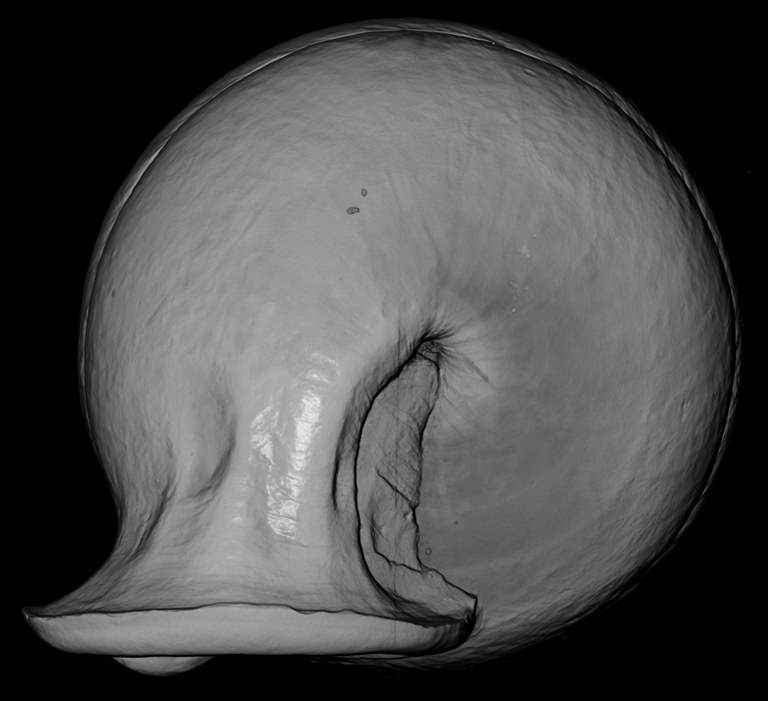 BE-RBINS-INV-MT-2825-Gulella-pilula-ct-anterior-BIG.jpg